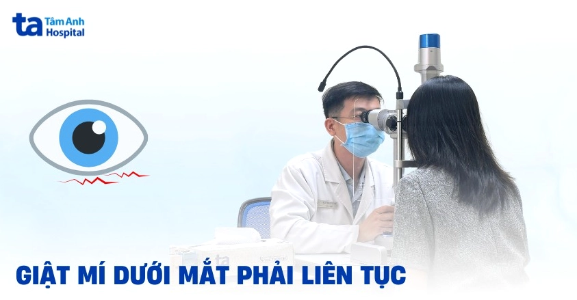 Giải Mã Hiện Tượng Mắt Phải Giật Liên Tục: Dấu Hiệu Sức Khỏe Bạn Cần Chú Ý