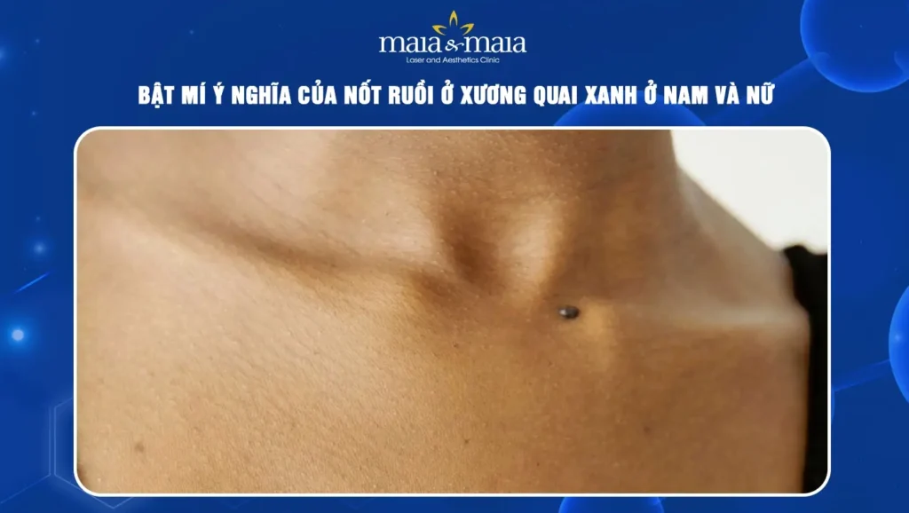 Giải mã ý nghĩa nốt ruồi ở xương quai xanh nam, nữ chi tiết nhất 2026