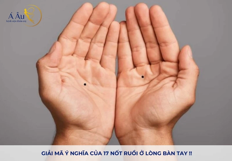 Giải Mã Ý Nghĩa Nốt Ruồi Trong Lòng Bàn Tay Chi Tiết, Chuẩn Xác