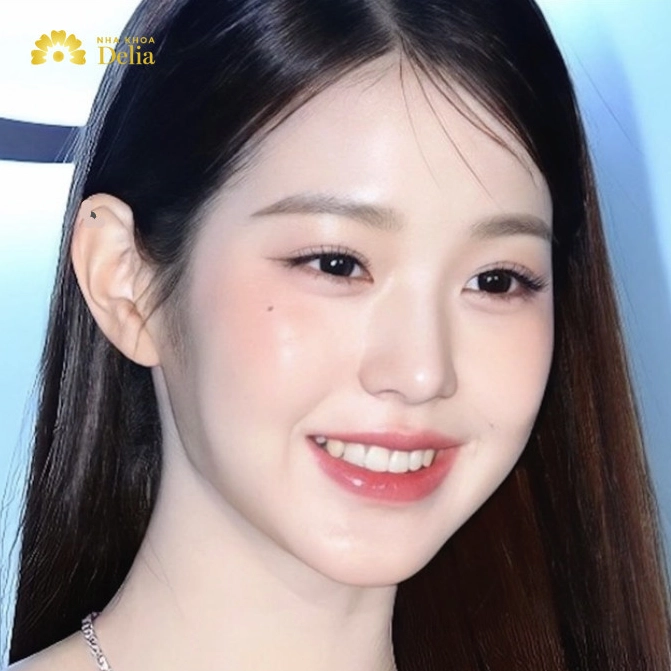 Nốt Ruồi Ở Vành Tai: Bí Ẩn Vận Mệnh Tài Lộc Phước Báu Cần Biết