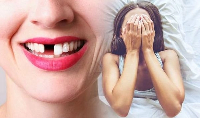 Tất cả những giấc mơ bị rụng răng mà không chảy máu không hẳn đều là điềm báo không tốt